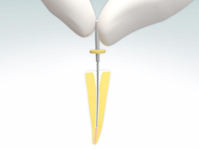 Endodontics