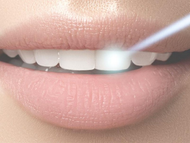 Laser Dentistry