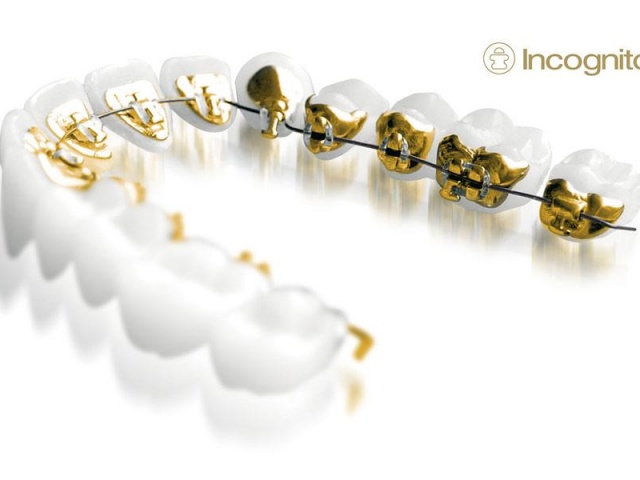 Orthodontics
